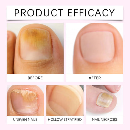 Nailora 2-in-1 Cuticle Oil Pusher Pen