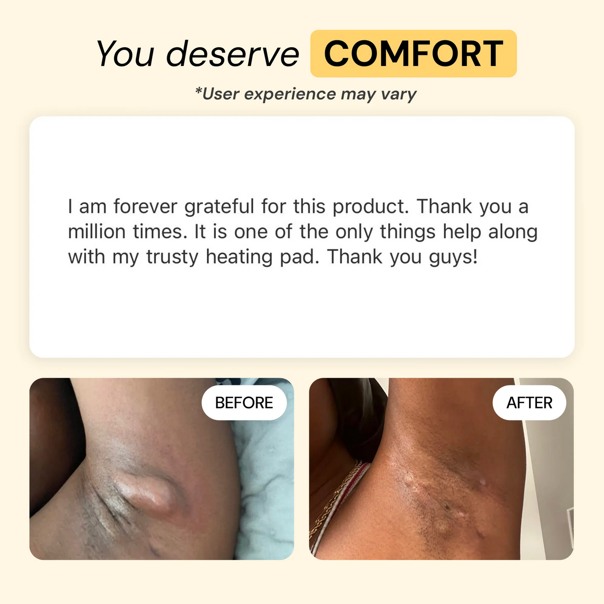 CalmVera – Natural Skin Soothing Balm for Irritation, Chafing & Friction-Prone Skin
