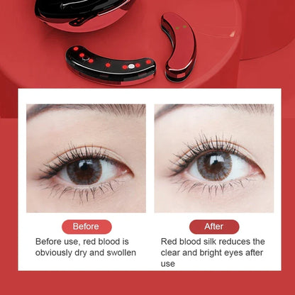 Eyemazing