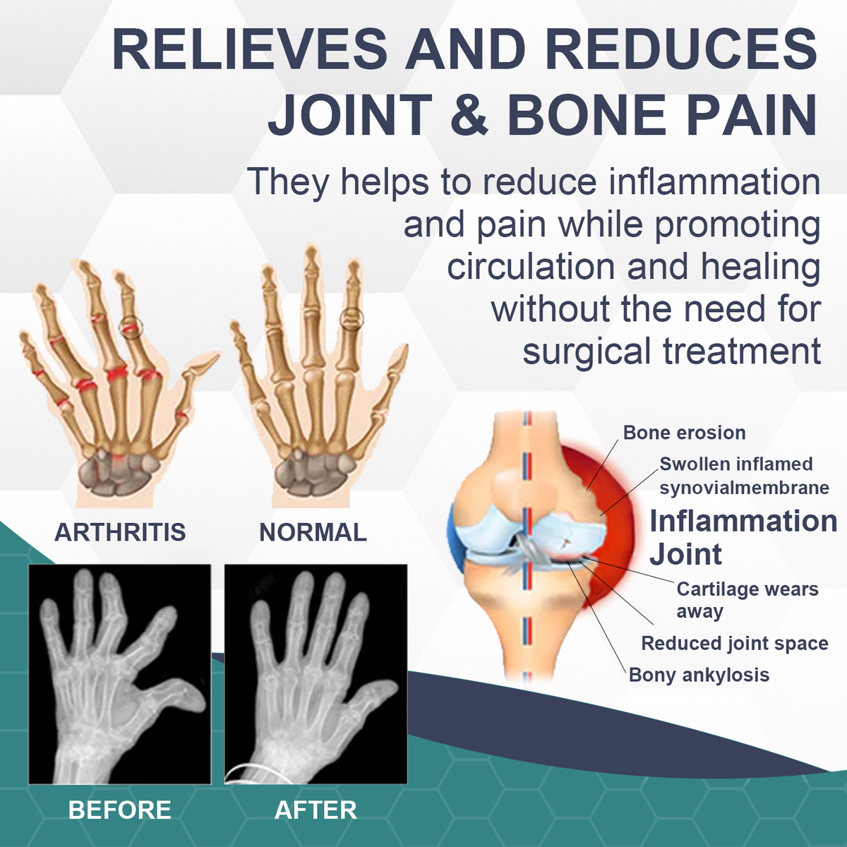 🐝 IFMAGIC™ Bee Venom Pain and Bone Healing Cream
