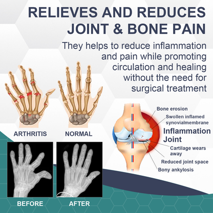 🐝 IFMAGIC™ Bee Venom Pain and Bone Healing Cream