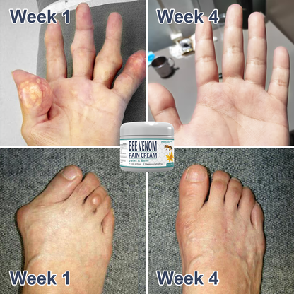 🐝 IFMAGIC™ Bee Venom Pain and Bone Healing Cream