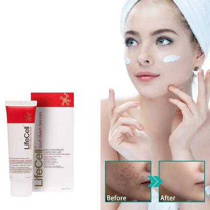 LifeCell All-in-One Anti-Aging Treatment