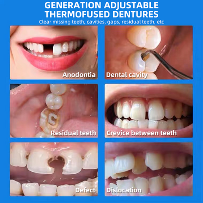💝Removable and reusable resin dental filling artifact💝