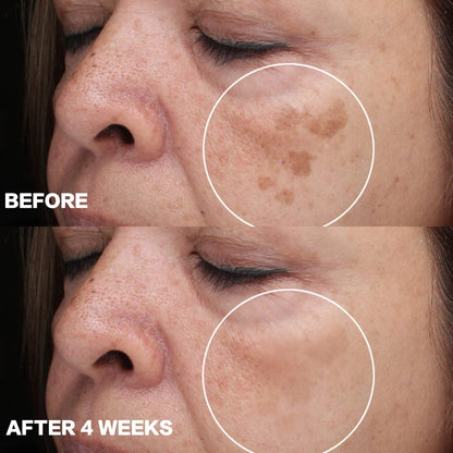 TURMERIC ANTI-OXIDATION SERUM