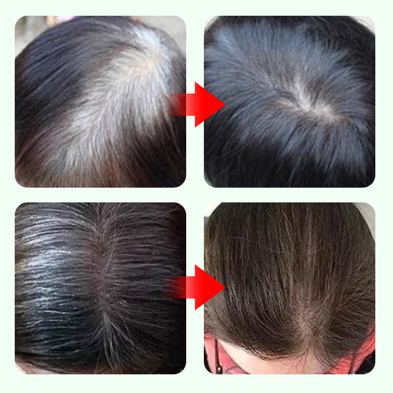 10-Second Root Rescue! Gray Coverage Hair Pen - Instant Youth in a Click!