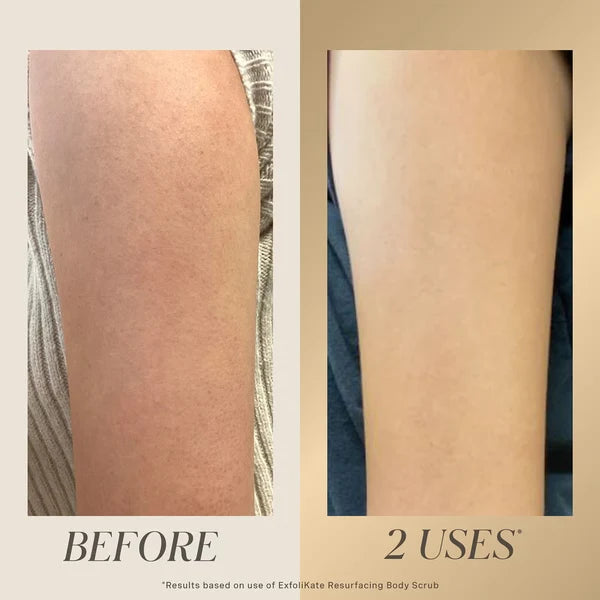 GlowVera – Gentle Exfoliating Cream for Dead Skin Removal, Smooth Texture & Radiant-Looking Skin