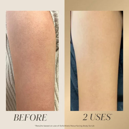 GlowVera – Gentle Exfoliating Cream for Dead Skin Removal, Smooth Texture & Radiant-Looking Skin